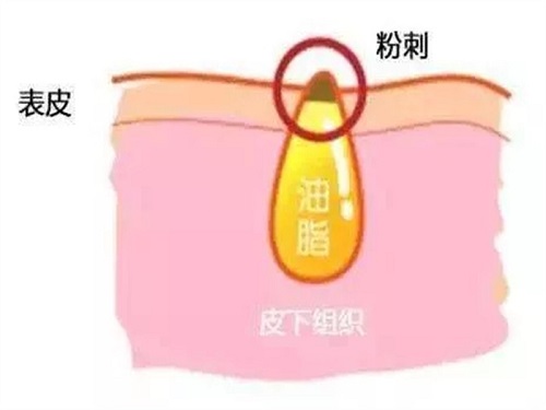 杭州玛妃医疗美容诊所|去痘的方法