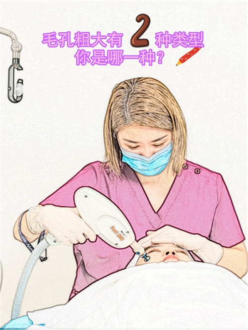  上海亚柏医疗美容诊所光子脱毛的操作步骤
