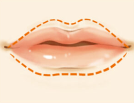 一般自体脂肪丰唇能维持多久？术后该如何护理呢？