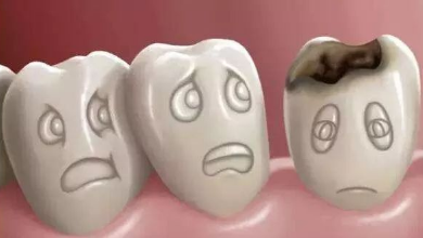 牙齿贴面有几种类型？解析！牙齿真实案例是真的好吗？