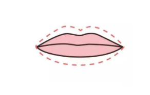 唇裂修复术的注意事项？唇腭裂修复手术方法有哪些？唇裂干货分享