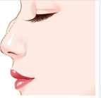 鼻头缩小哪里做得好？鼻头缩小的手术方式有三种！隆鼻价格表！